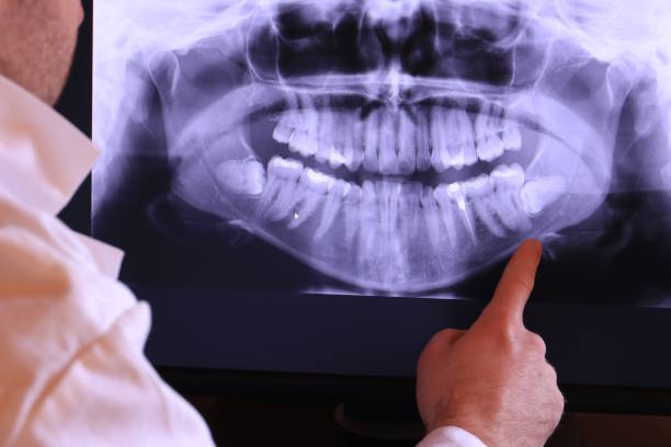 Best Knocked-Out Tooth Emergency  in Pacifi, CA